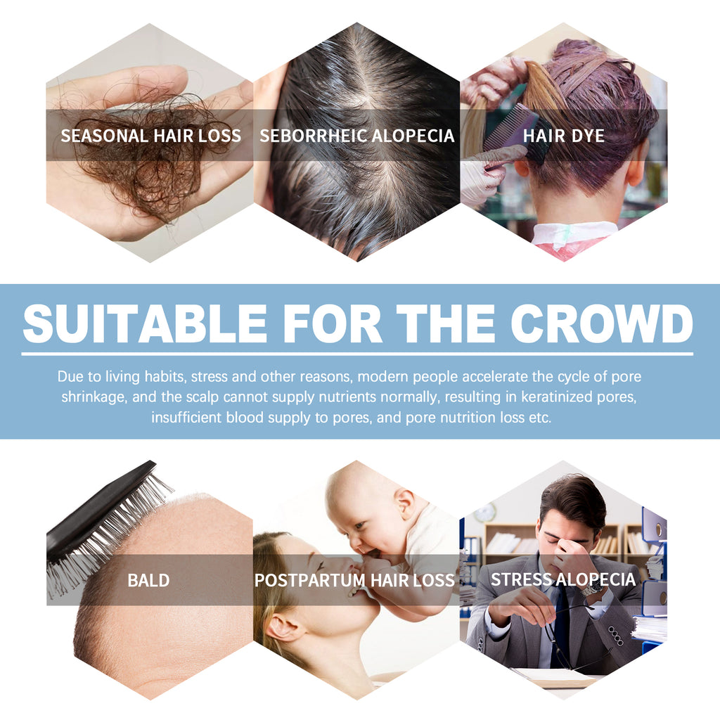 RootRevive Hair Growth Ampoule – Scalp Nourishing, Strengthening & Hair Restoration Treatment