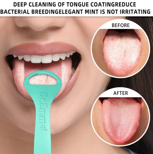 Fresh Breath Tongue Cleaner Scraper – 6 Pack